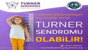 Az bilinen sık görülen: “Turner sendromu”