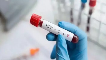 15-19 yaşta HIV alarmı